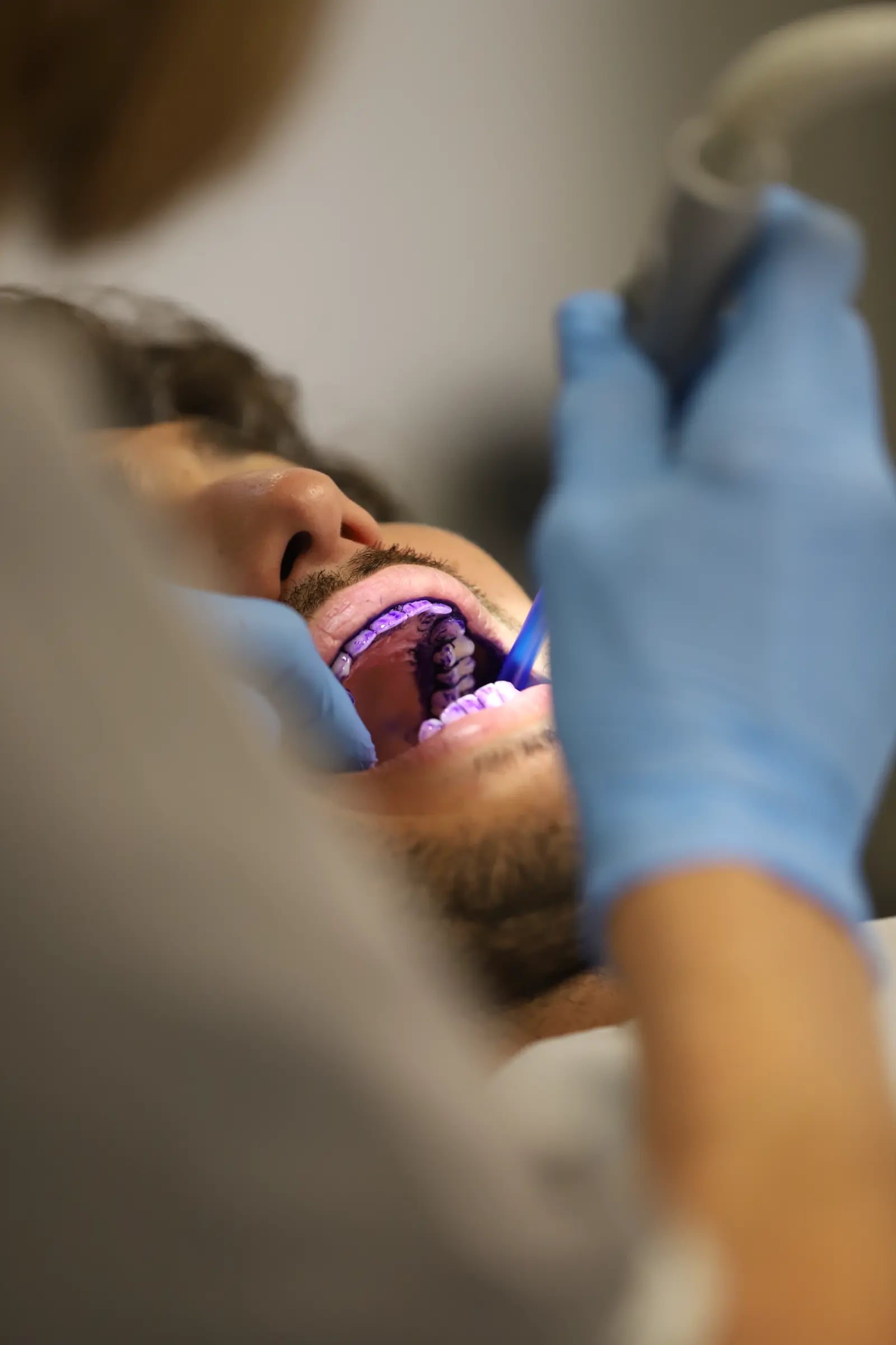 Close-up of a dentist scanning a patient's teeth