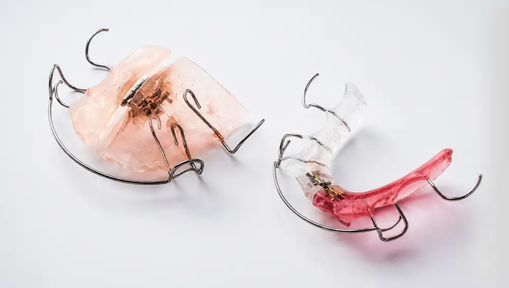 Custom and special-order orthodontic appliances at Adam Labs