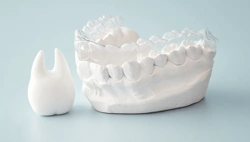 Indirect bonding trays, digital setup and transfer trays at Adam Labs