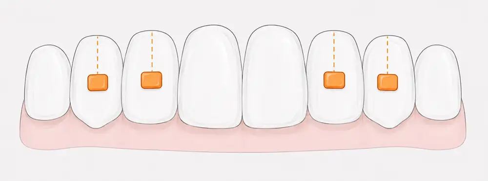 Mia treatment planning preview: AI segmentation with Mia clinical protocol review