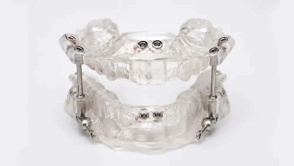 Surgical splints for orthognathic surgery: Adam Labs